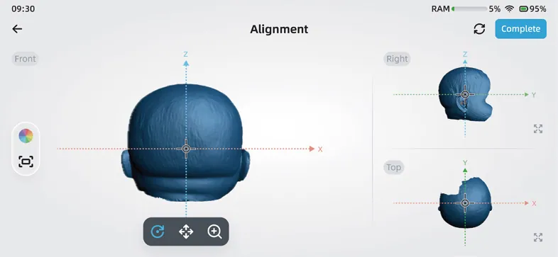 Interface EinScan Medixa — Alignement