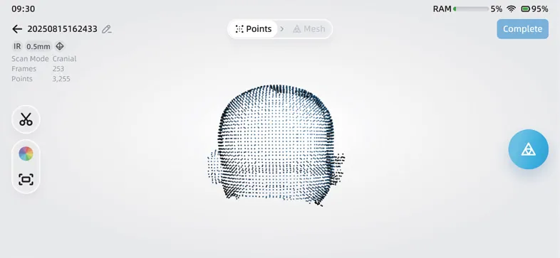 Interface EinScan Medixa — Numérisation